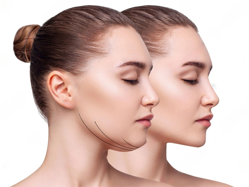 Lipolysis Double Chin Reduction (PB SERUM)